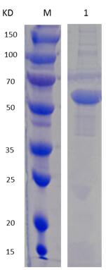 12% SDS-PAGE analysis profiles of purified MCR_RS07635-27-453 (CBB stained).